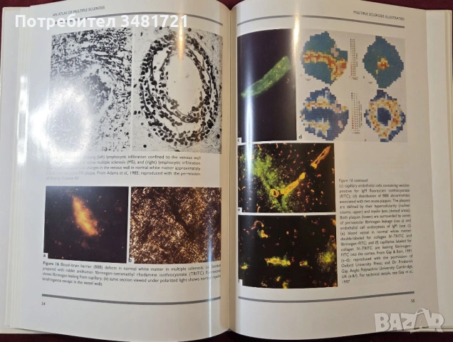 Голям атлас на множествената склероза / An Atlas of Multiple Sclerosis, снимка 7 - Специализирана литература - 53748194