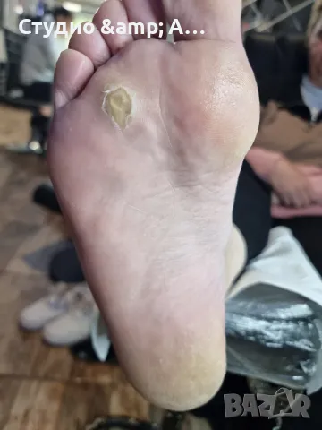 Модул Медицински педикюр, снимка 4 - Курсове за маникюристи - 49209316