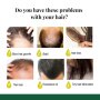 Многофункционален продукт за коса – растеж, заздравяване и сгъстяване., снимка 3