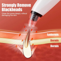 Уред за премахване на черни точки акне пъпки вакуум, снимка 3 - Козметика за лице - 36157538