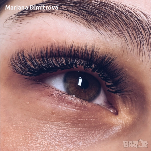 Миглопластика - Промоционална цена, снимка 1