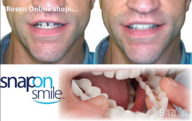 Подарете си перфектна усмивка с иновативната протеза Snap-On Smile, снимка 2 - Декоративна козметика - 44310205