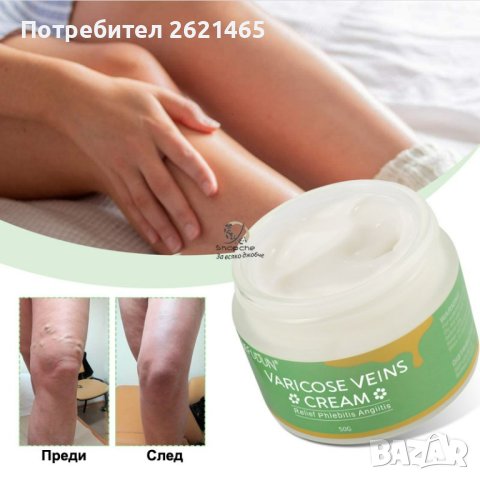 Крем за разширени вени с лечебни свойства от 6 билки с мощно действие, снимка 2 - Козметика за тяло - 42449636