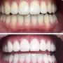 Паста за зъби „Extra White PRO”, 60 гр, снимка 2