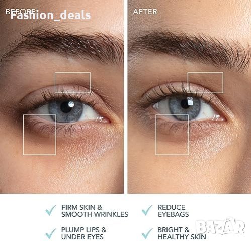 Ново FOREO Bear 2 Eyes & Lips: Микротоково Лифтинг Устройство за лице кожа жени, снимка 5 - Други - 42742076