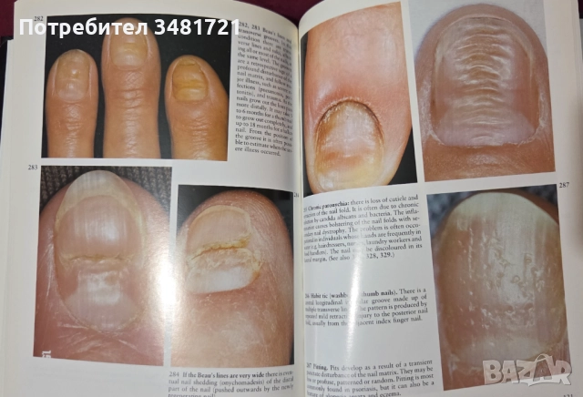 A Colour Atlas of the Hair, Scalp and Nails, снимка 12 - Специализирана литература - 52539726