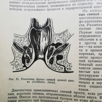 Симптоматична диагностика на хирургичните заболявания-1973г.руско издание, снимка 5 - Специализирана литература - 44592478