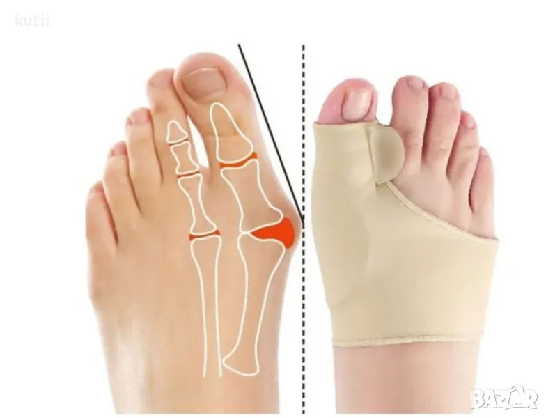 🔥САМО СЕГА!НАМАЛЕНИЕ НА КОРИГИРАЩИ ортопедични чорапи за палеца🔥 🔥ПРОМО ЦЕНА 6,99 лв🔥, снимка 1