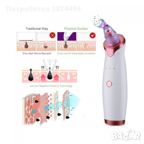 1431 Вакуумен уред за премахване на черни точки от лицето, снимка 9 - Масажори - 35785118