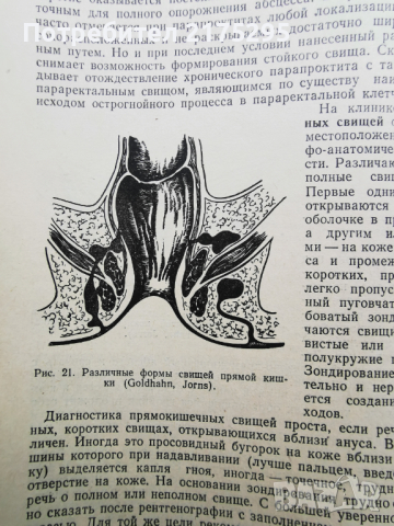 Симптоматична диагностика на хирургичните заболявания-1973г.руско издание, снимка 5 - Специализирана литература - 44592478