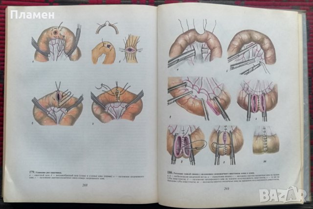 Атлас гинекологических операций /Руски език/, снимка 11 - Специализирана литература - 35835220