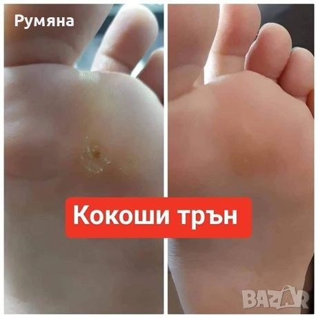 Тинктура срещу папиломи брадавици и кокоши трън , снимка 3 - Други - 52431713