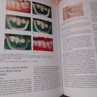 Оперативно зъболечение- Oxford, снимка 10 - Специализирана литература - 43910992