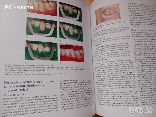 Оперативно зъболечение- Oxford, снимка 10 - Специализирана литература - 43910992