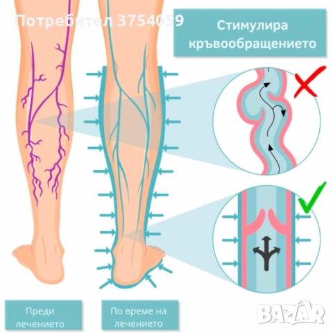 Апарат за венозна тренировка и облекчение на тежестта в краката Venen Walker Basic, снимка 5 - Други - 53209439