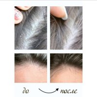 !!!ПРОМО!!! Комплект грижа за косата и скалпа от TianDe , снимка 12 - Продукти за коса - 42622599