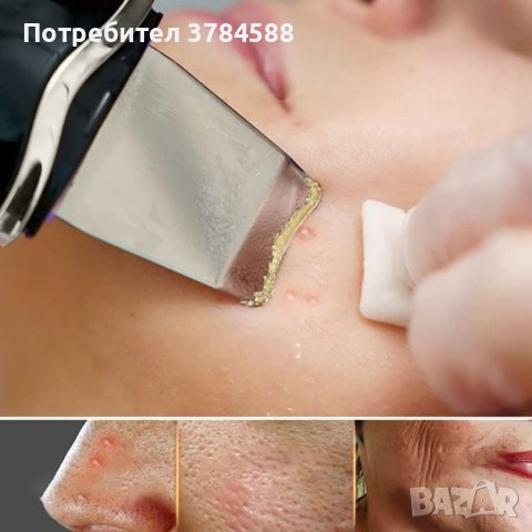 Ултразвукова шпатула Ntech за дълбоко почистване, снимка 2 - Друга електроника - 41508987