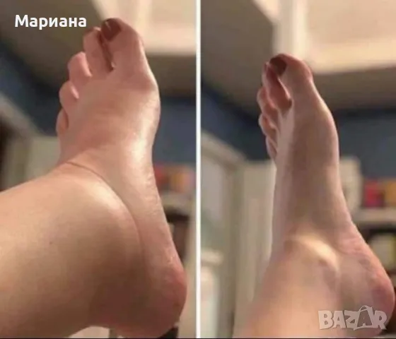 Премахване на целулит, отоци и вени, снимка 8 - Козметика за тяло - 48874618