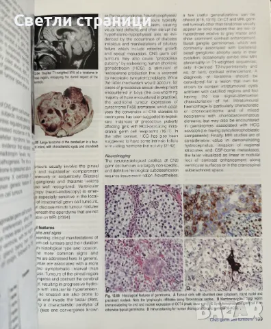 World Classification of Tumours of The Central Nervous System, снимка 3 - Специализирана литература - 48316593