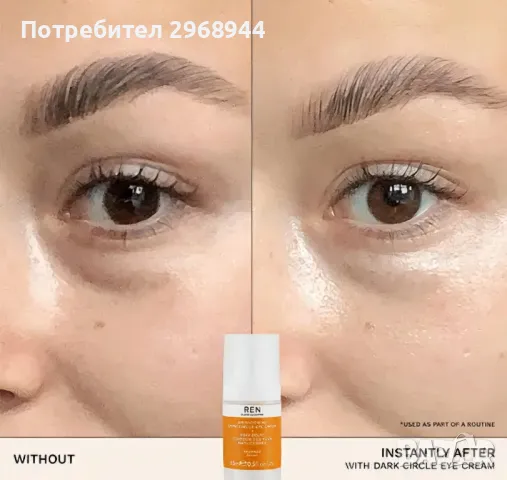 REN  Radiance Brightening Dark Circle Eye Cream, околоочен крем против тъмни кръгове около очите, снимка 3 - Козметика за лице - 49855718