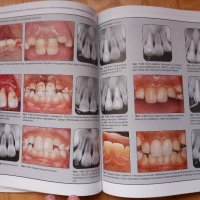 Травматизирани зъби- лечение, Митсухиро Тсукибоши, снимка 5 - Специализирана литература - 43910903