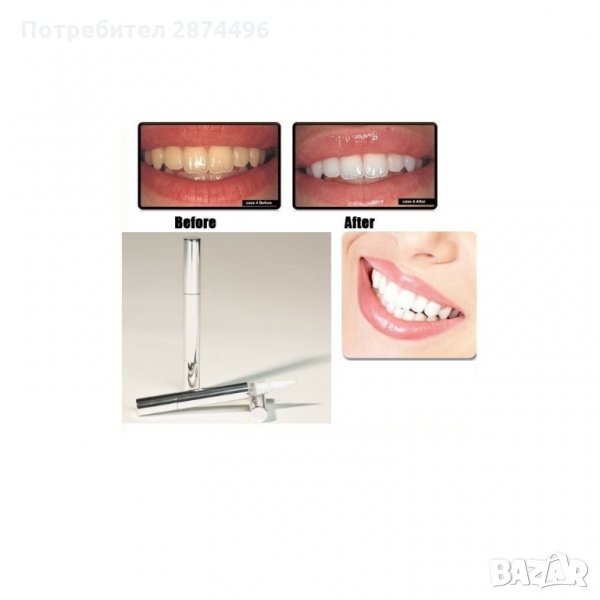 0745  Избелваща писалка за зъби, снимка 1