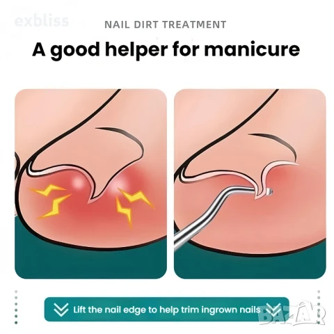 Инструмент за корекция на врастнали нокти, снимка 2 - Продукти за маникюр - 50761150