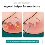 Инструмент за корекция на врастнали нокти, снимка 2
