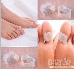 Магнитни пръстени за отслабване