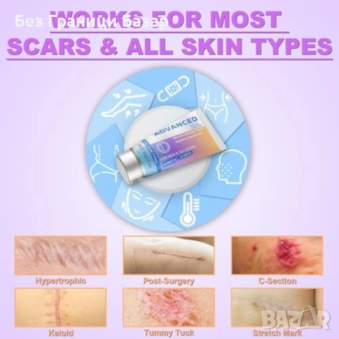 Нов Интензивен крем за белези и стрии – изглаждане и възстановяване на кожата, снимка 5 - Други - 51905727