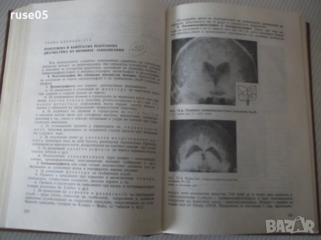 Книга "Неврология - Сашо Божинов" - 444 стр., снимка 10 - Учебници, учебни тетрадки - 53218764