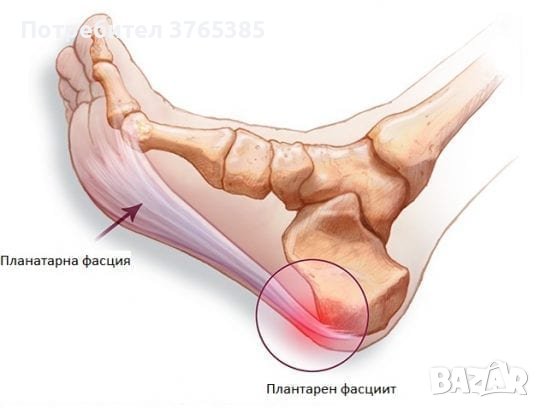 Ортопедични Стелки Дюстабан Плоскостъпие Паднал Свод Плоско Стъпало Плантарен Фасциит O/X Крака X/О, снимка 15 - Ортопедични стелки - 41263139