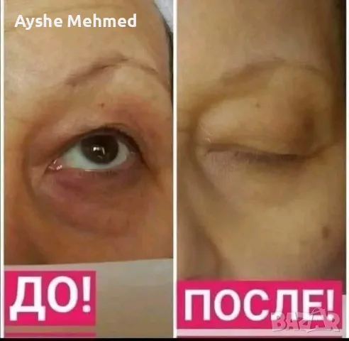 Крем за клепачи против бръчки Sheep Placenta, 50 гр, снимка 3 - Козметика за лице - 55709768