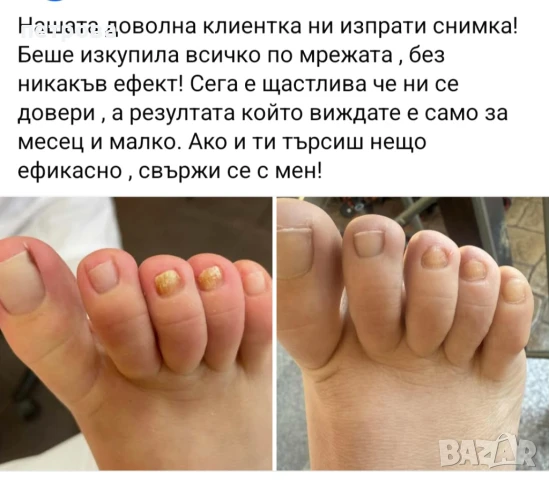 Пчелен мехлем за гъбички по ноктите и кожата