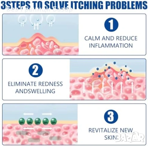 Нов Натурален крем при псориазис – без аромат, нежен към чувствителна кожа, снимка 5 - Други - 53368793
