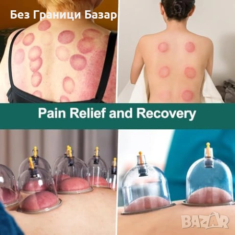 Нови Вендузи за вакуум масаж 16 броя голям размер за гръб тяло мускули , снимка 6 - Други - 53815939