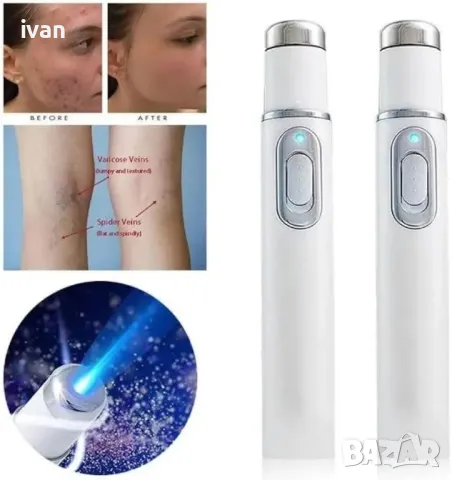 Уред за премахване на Акне и петна Acne fighting secret KD7910 , снимка 2 - Козметика за лице - 49832229