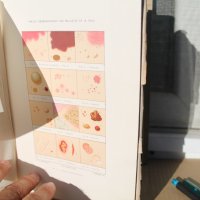 Френска медицинска книга за кожни заболявания, снимка 11 - Специализирана литература - 42654446