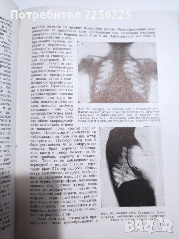 Ръководство по болести на дихателната система , снимка 3 - Специализирана литература - 41716564