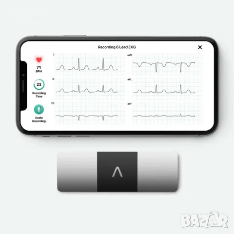 AliveCor KardiaMobile 6L – 6-канален преносим ЕКГ апарат