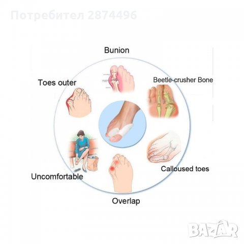 FOOTMATE Силиконов разделител при изпъкнало кокалче на крака халукс валгус, снимка 3 - Други - 35784279