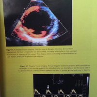 Echocardiography in clinical practice John Chambers, снимка 4 - Специализирана литература - 36030933