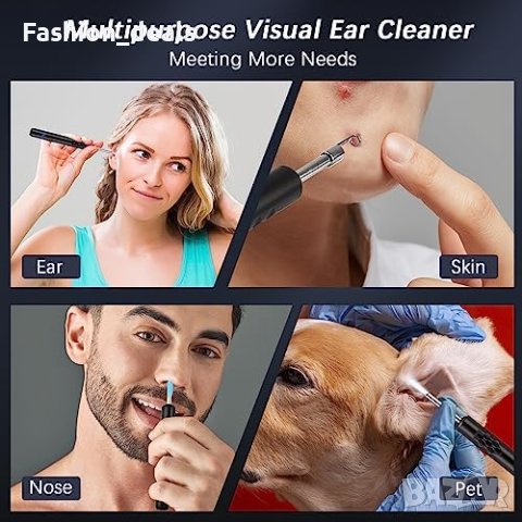 Нов Комплект за отстраняване на ушна с камера черни точки отоскоп, снимка 2 - Други - 42020235