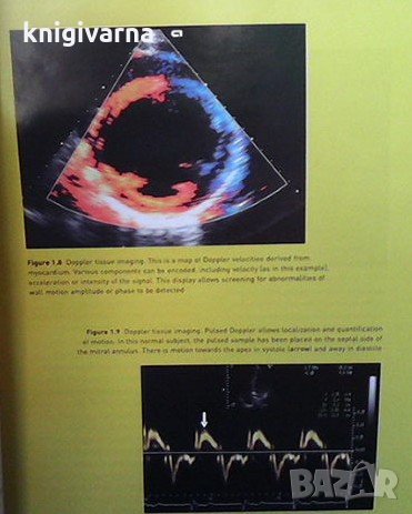 Echocardiography in clinical practice John Chambers, снимка 4 - Специализирана литература - 36030933