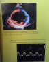Echocardiography in clinical practice John Chambers, снимка 4