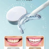 Комплект за избелване на зъби, снимка 5 - Други - 41461555