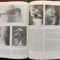 Рентгенова и радиоизотопна диагностика на заболяванията на сърцето и големите съдове, снимка 4 - Специализирана литература - 35848291