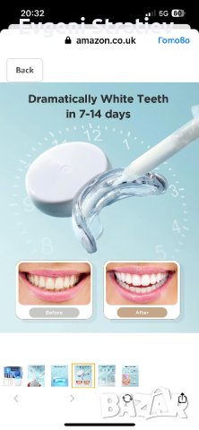 Комплект за избелване на зъби, снимка 5 - Други - 41461555