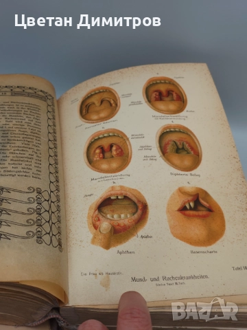 Антикварна находка Книга от 1921 г. - Жената като семеен лекар, снимка 5 - Антикварни и старинни предмети - 52856786