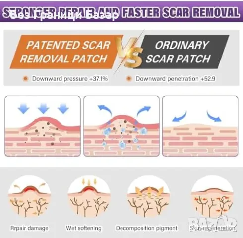 Нова Силиконова лепенка за белези – ефективно намалява стрии, снимка 3 - Други - 49294914